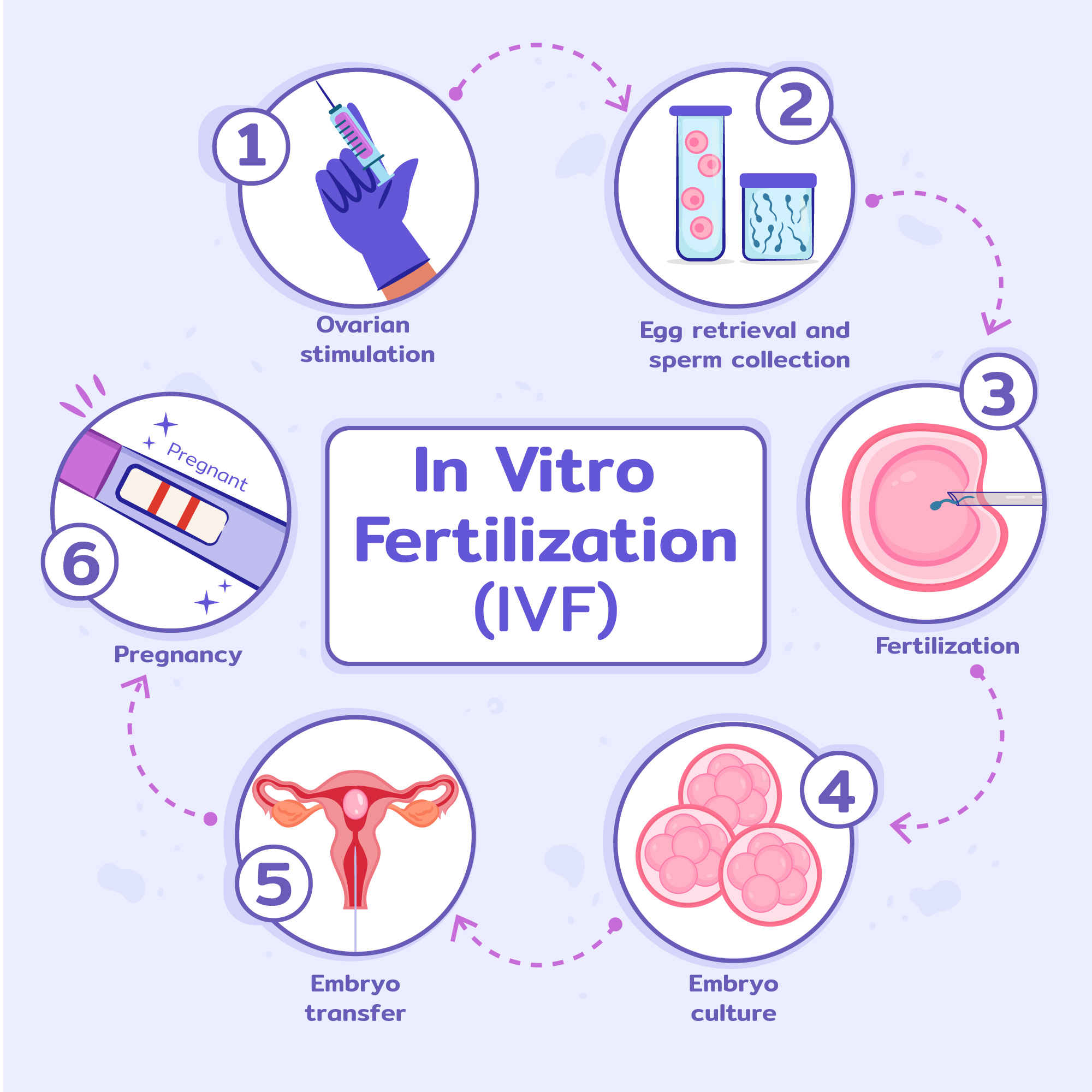 What is IVF? IVF process infograf
