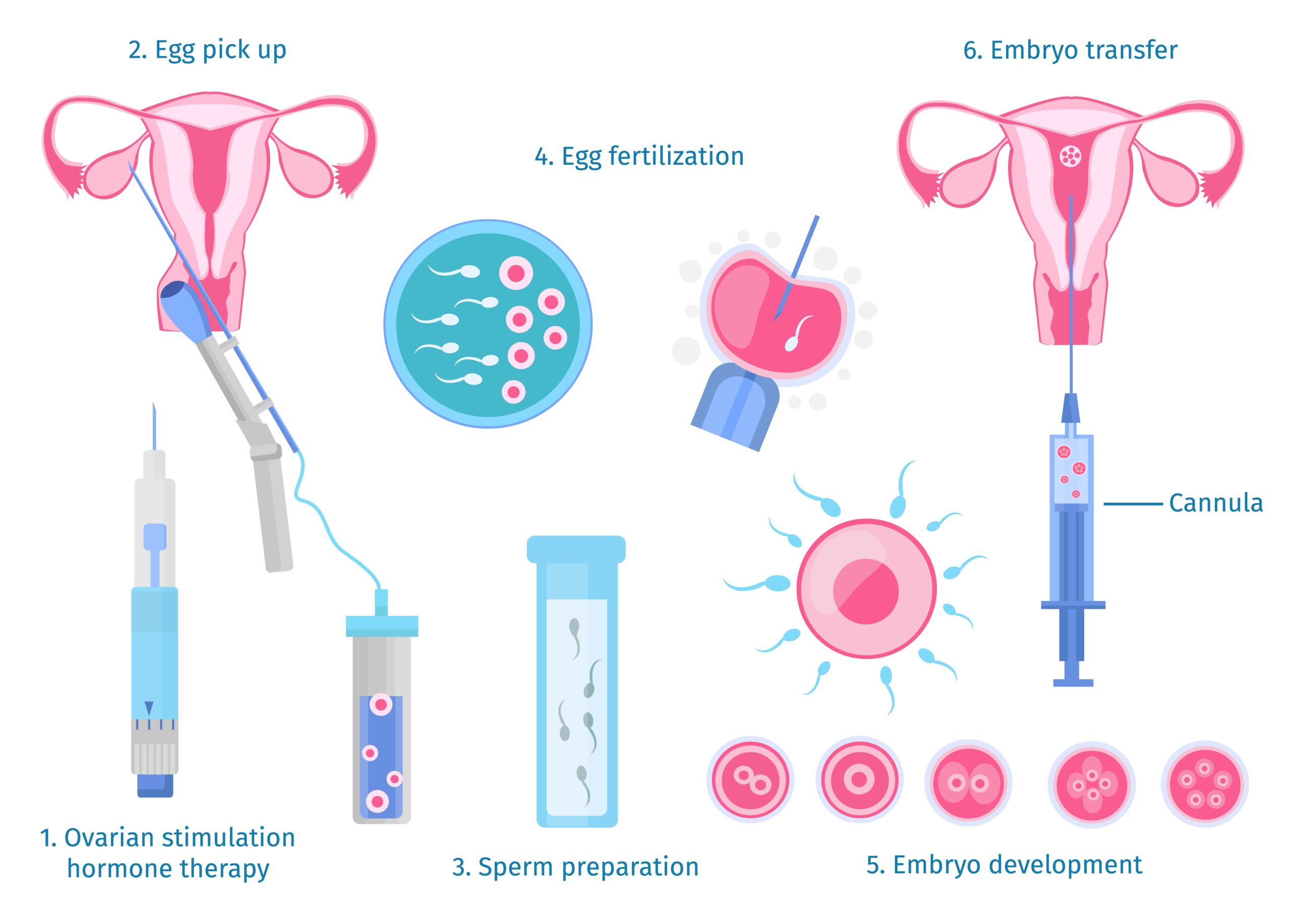 IVF and IUI